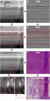 Nitric Oxide Is Essential for Generating the Minute Rhythm Contraction Pattern in the Small Intestine, Likely via ICC-DMP